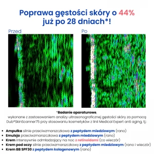 Krem pod oczy silnie przeciwzmarszczkowy z peptydem miedziowym grafika 5